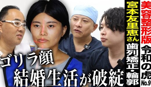 【合同カウンセリング編】ゴリラ顔に悩む！骨格は何が問題？歯列矯正・輪郭形成 ┃宮本 友里恵さん┃ 9人目┃美容整形版令和の虎【東京美容外科】