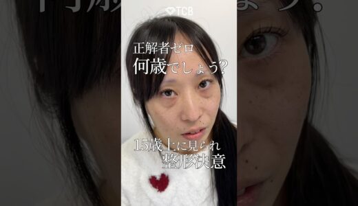 【クマ取り】正解者ゼロ。何歳でしょう？15歳上に見られ整形決意#shorts