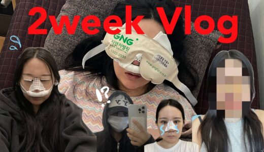 【韓国】目と鼻整形しましたVLOG👀👃手術当日〜2週間分の経過全てお見せします！！！