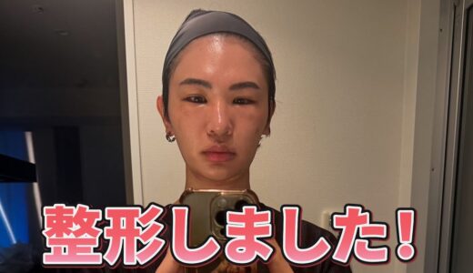 【美容整形】美容外科医が整形してみた！ダウンタイム公開！