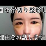 【骨切り整形】命懸けの手術を6回もしたキ○ガイの考えてること知りたくない？w