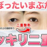 【二重整形】厚ぼったいまぶたでも綺麗な二重になるための美容整形を解説