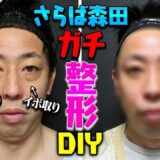 【さらば森田 ガチ整形DIY】クマ&イボ除去で大変身！！