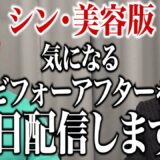 激変した志願者の様子を同日に配信！？美容整形版に代わる『シン・美容版』の進化とは…？美容の力で変わるその後の人生を見逃すな！