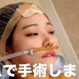 【美容整形】私の長年のコンプレックがたった数時間で解決しました。