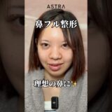 理想の鼻になれる😳♥️#astrabeautyclinic  #アストラビューティークリニック #塩満恵子 #鼻整形 #美容整形 #忘れ鼻