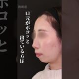 横顔美人の作り方 大公開 #美容整形